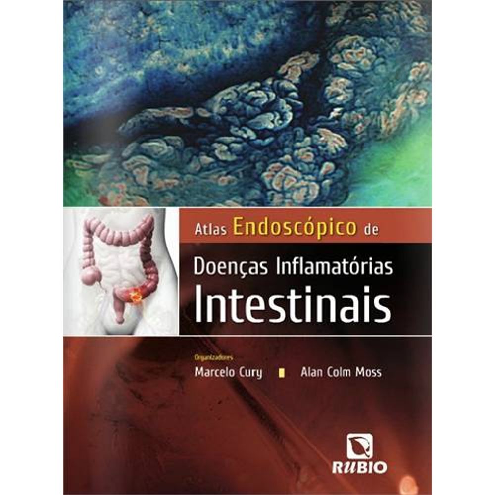 Livro Atlas Endoscopico De DoenÇas Inflamatorias Intestinais Livraria Cultura Livraria Cultura 