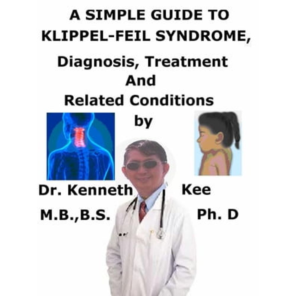 What to Know About Klippel-Feil Syndrome